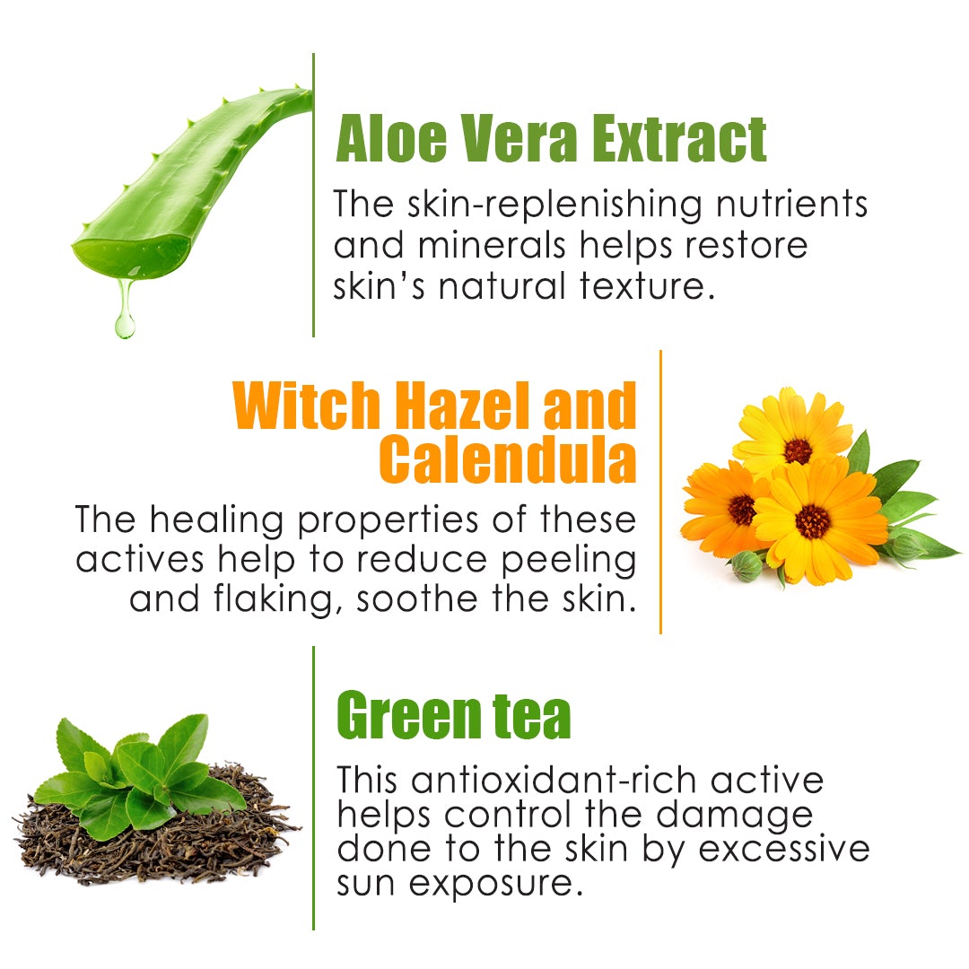 WOW Aloe Vera with Hyaluronic Acid, Witch Hazel Extract, Green Tea & Calendula Hydrating After Sun Soothing Gel - No Parabens, Silicones & Color - 100 ml